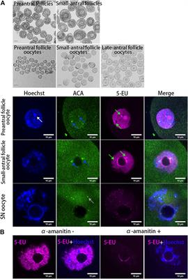 Dynamic of centromere associated RNAs and the centromere loading of DNA repair proteins in growing oocytes